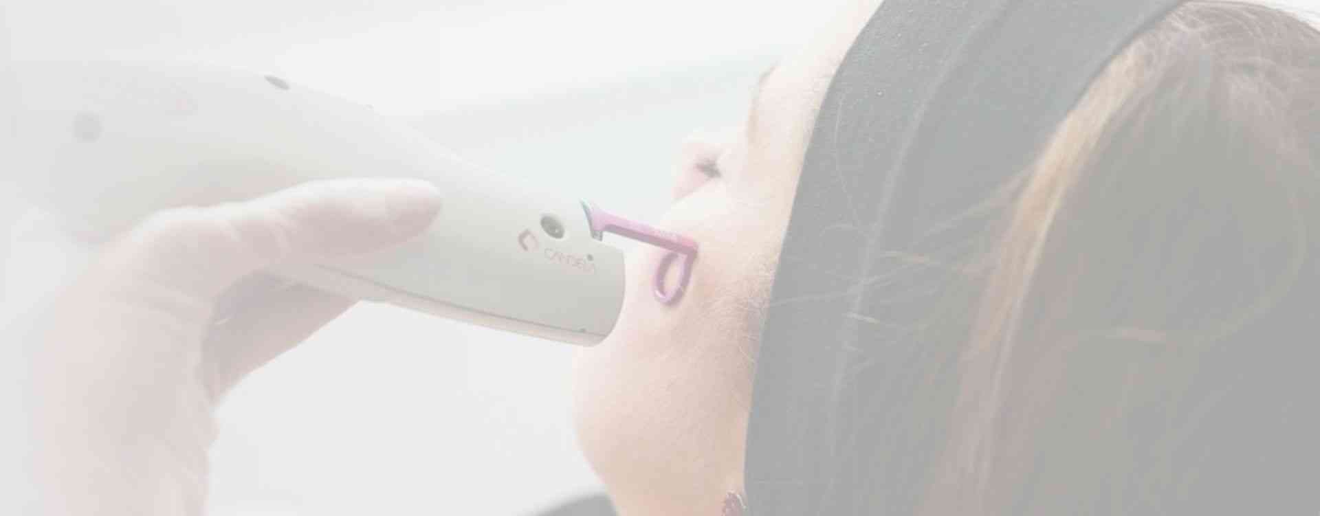 pulse dye laser face redness treatment